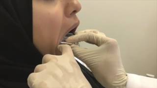 Dentiscope  How to Take Bitewing Radiograph [upl. by Nylsirk826]