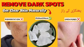 Fitkari ke fayde Get Clear and spotless skin How to use Phitkarialum Say Goodbye to Dark spots 💯 [upl. by Llenrag]