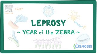 Leprosy Year of the Zebra [upl. by Tabbi212]