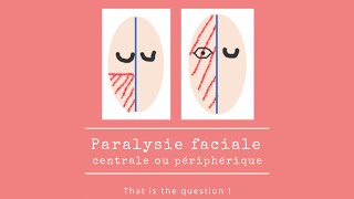 Paralysie faciale  Centrale ou Périphérique [upl. by Poppo]