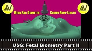 Fetal Biometry Part II MSD and CRL [upl. by Emily]