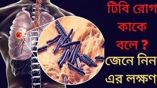 টিবি রোগ কি  What Is TB Disease In Bangla [upl. by Tiffa26]