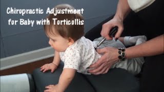 Chiropractic Adjustment for Baby with Torticollis [upl. by Anale339]