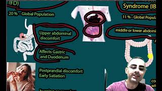 Functional Dyspepsia FD vs Irritable Bowel Disease IBS [upl. by Ariad]