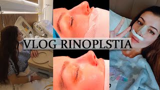 MI RINOPLASTIA VLOG DÍA A DÍA  rhinoplasty experience [upl. by Nodnorb103]