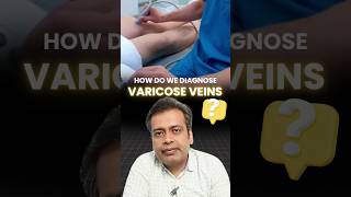 How do we diagnose VARICOSE VEINS  varicose veins examination  Varicose Veins Treatment Mumbai [upl. by Kursh382]