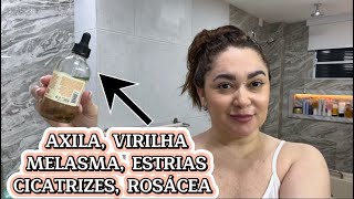 ISSO CLAREIA TODO TIPO DE MANCHA AXILA VIRILHA MANCHA DE GRAVIDEZ MELASMA ESPINHA [upl. by Kieffer]