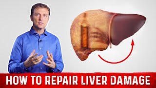 How To Repair Liver Damage After Alcohol – DrBerg on Liver Cirrhosis [upl. by Anyotal874]