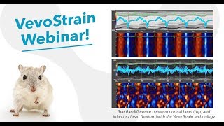 Oct 2017 VevoStrain  Understanding Subtle Cardiac Changes [upl. by Aehc865]