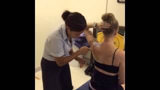 Upward rotation scapular taping [upl. by Anuahs]