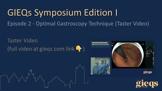 Episode 2  Optimal Gastroscopy Technique Taster Video​ [upl. by Redneval]