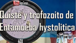 Entamoeba histolityca trofozoito y quiste trophozoite and cyst [upl. by Airotkiv]