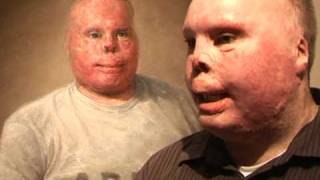 Disfigured Iraq veterans portrait on display [upl. by Alohs113]