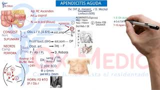 Ficha resumen Cirugía general Apendicitis aguda ENAMENARMSERUMS [upl. by Ettezzil]