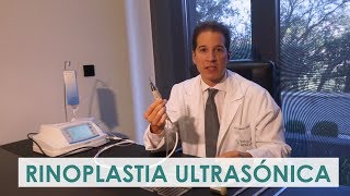 Rinoplastia ultrasónica la mejor técnica para operar la nariz Dr Macía Icifacial [upl. by Crin37]