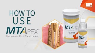 How to Use MTApex™ bioceramic root canal sealer  StepbyStep [upl. by Anoyet]