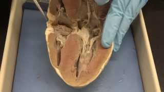 Cardiovascular system Part 3a  Heart dissection [upl. by Adnawt]