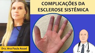 Complicações da esclerose sistêmica no coração pulmões rins intestinos e outros locais do corpo [upl. by Haley33]