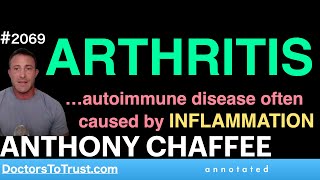 ANTHONY CHAFFEE a1  ARTHRITIS …autoimmune disease often caused by INFLAMMATION [upl. by Narot654]