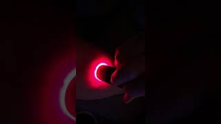 Illumivein Vein Finder In Use  Demonstration Video [upl. by London]