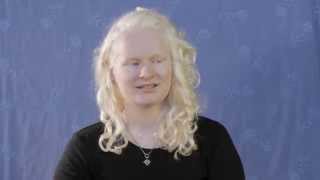 Living with Albinism  Karina [upl. by Nogem]