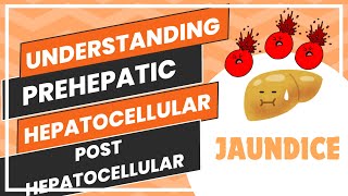 Understanding Jaundice  PreHepatic Hepatocellular and PostHepatocellular jaundice [upl. by Pardner523]