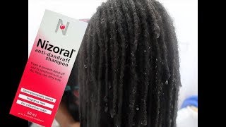 NIZORAL ANTI DANDRUFF SHAMPOO FIRST IMPRESSIONS HMMMMMM [upl. by Warrick247]