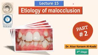 Etiology of malocclusion lec15 part 2 [upl. by Sandstrom]