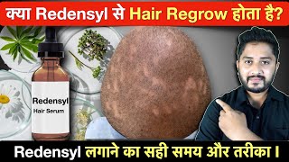 क्या Redensyl से Hair Regrow होता है Redensyl Serum for Hair Growth [upl. by Otanod27]