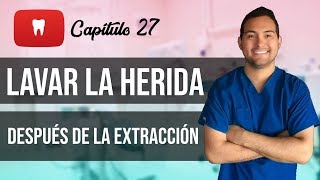 LAVAR LA HERIDA CUIDADOS DESPUÉS DE UNA EXTRACCIÓN DE MUELA 👄 2018 27 [upl. by Asia]