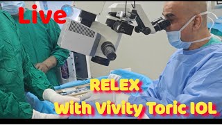 Live RELEX with Vivity Toric IOL in a Myopic Eye Dr Kamal Kapoor [upl. by Winna]