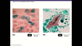 BIO 220 Chapter 13  Viruses Prions Viroids [upl. by Eloc]