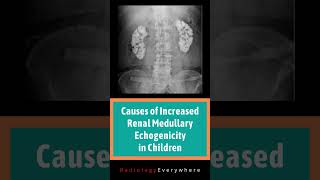 Renal Medullary Echogenicity  Medullary nephrocalcinosis  Radiology  causes  video 47  Shorts [upl. by Ful]