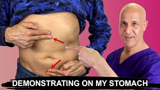 Stop Bloating amp Constipation in 2 Moves Demonstrating My Stomach Dr Mandell [upl. by Sprung]