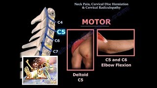 Neck Pain Cervical Disc Herniation amp RadiculopathyEverything You Need To Know  Dr Nabil Ebraheim [upl. by Honebein910]