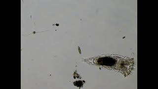 Diatom Becomes a Snack for a Rotifer [upl. by Inram417]