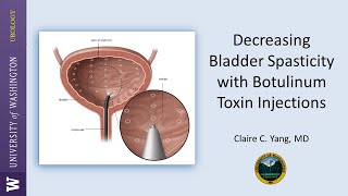 Decreasing Bladder Spasticity With Botulinum Toxin Injections [upl. by Zedecrem]