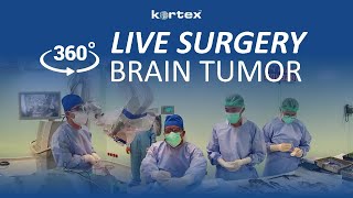 360⁰ LIVE SURGERY Brain Tumor [upl. by Aratihc896]