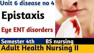 Epistaxis  Nose bleeding  Causes  Home Treatment  Nursing Lecture  Adult health nursing [upl. by Euqimod]