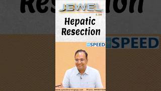 Hepatic Resection by DrKVinayak Senthil neetss iniss medico neetpg [upl. by Dam]