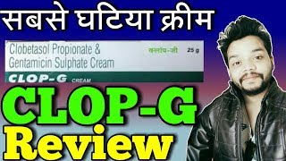 CLOP G Cream Review  CLOPG side Effects in hindi [upl. by Clothilde451]