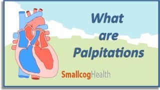 What are Palpitations [upl. by Kcirted606]