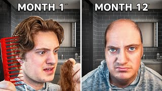 How To Tell if You Are Going BALD amp how to fix it [upl. by Hetti152]