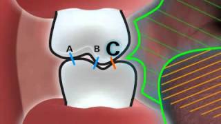 The optimal tooth contacts [upl. by Koh]