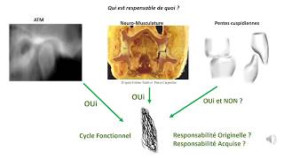 Volume Fonctionnel de la Cinématique Mandibulaire [upl. by Atnicaj]