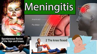 meningitis encephalitis vs meningoencephalitis PEV [upl. by Thilda]