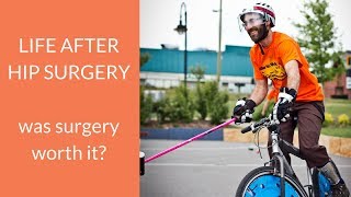 Is surgery for a hip labral tear worth it Jawns journey with hip pain [upl. by Nananne]