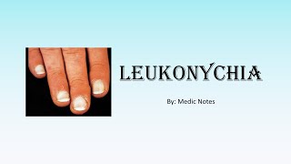 Leukonychia  causes and pathophysiology [upl. by Yager]