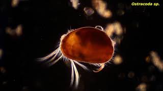 Ostracoda sp  Protozoans and other small critters [upl. by Nylissej968]