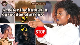 Voici Pourquoi tu PERDS tes CHEVEUX et comment les traiter  perte cheveux tempes chute cheveux [upl. by Calise812]